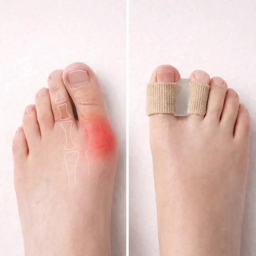 Toe Separators for Bunions, Gel Toe Spacers for Hallux Valgus & Crooked Toes, 1 Pair