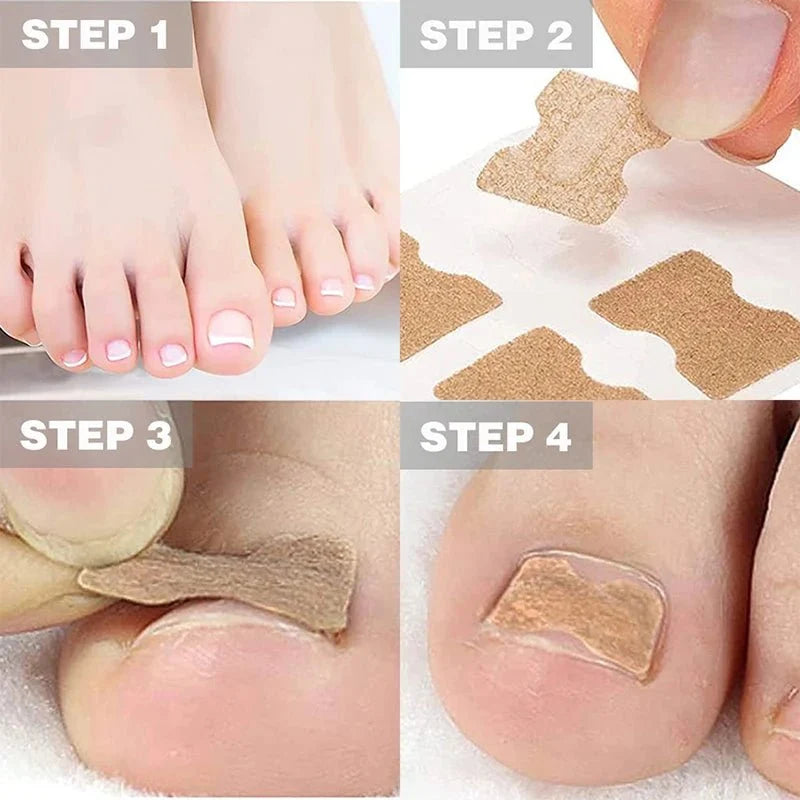 FixaNail Gentle Nail Correction