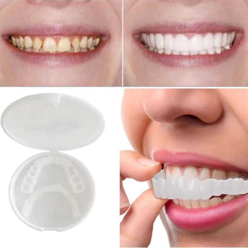SNAPFIT SMILE Tooth Restoration