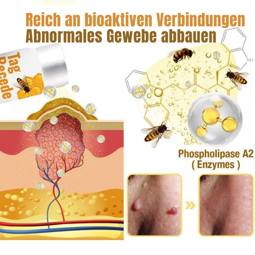 Wart Remover Spray, Gentle Bee Venom Inspired Skin Care Spray with Painless Application, 20 ml