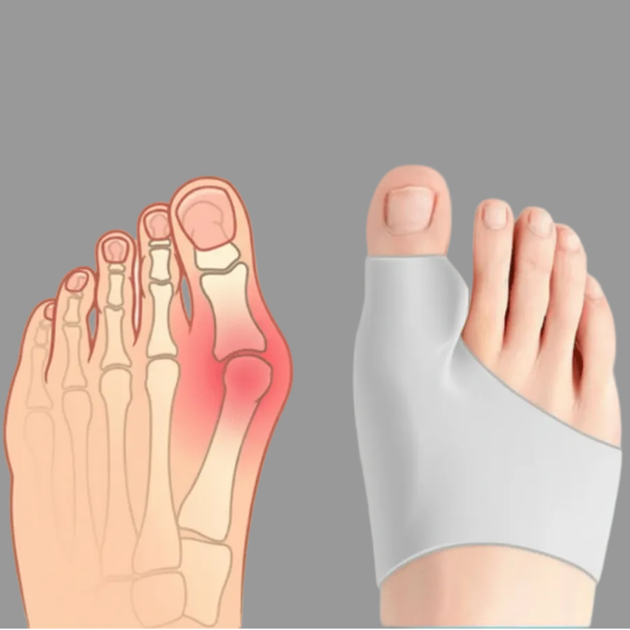 COMPRESSCARE TEEN Hallux Valgus Corrector