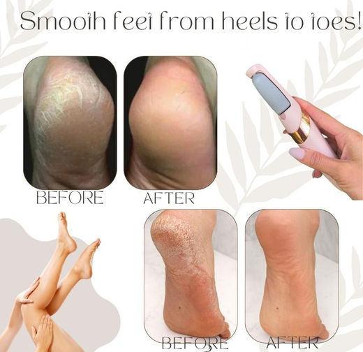 Electric Callus Remover, Rechargeable Foot File with 2 Rollers for Hard Skin on Heels & Feet