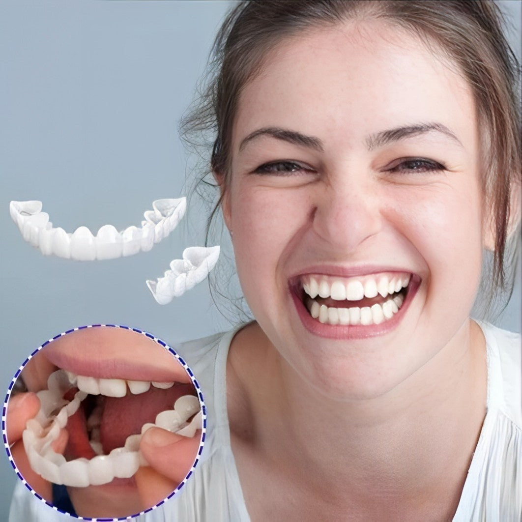 Hollywood Smile Snap On Veneers – photo 10