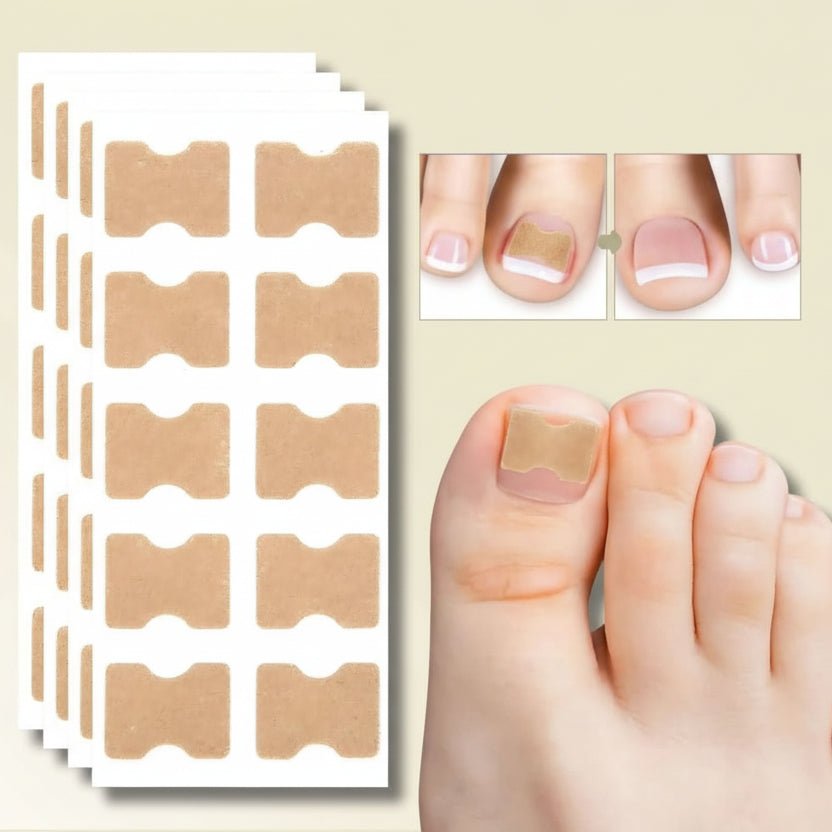 FixaNail Gentle Nail Correction lifestyle 2