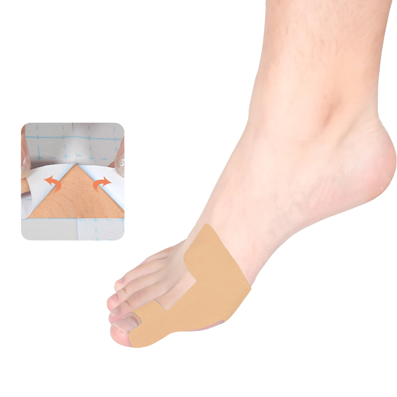 Bunion Corrector Brace, 80 Pieces