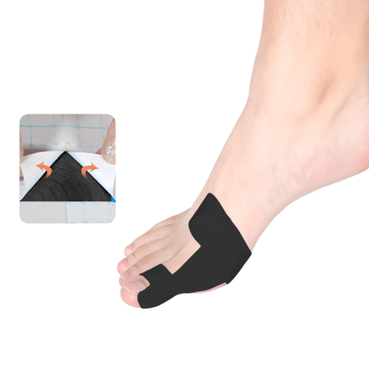 Bunion Corrector Brace, 80 Pieces