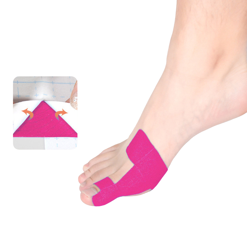 Bunion Corrector Brace, 80 Pieces