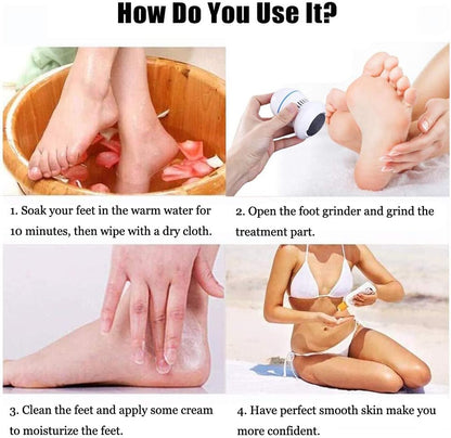 PEDIFEET Wireless Foot Care Device
