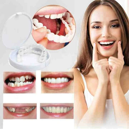 Snap-On Instant Veneers for Upper and Lower Teeth