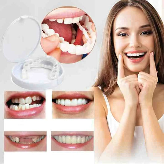 Snap-On Instant Veneers for Upper and Lower Teeth