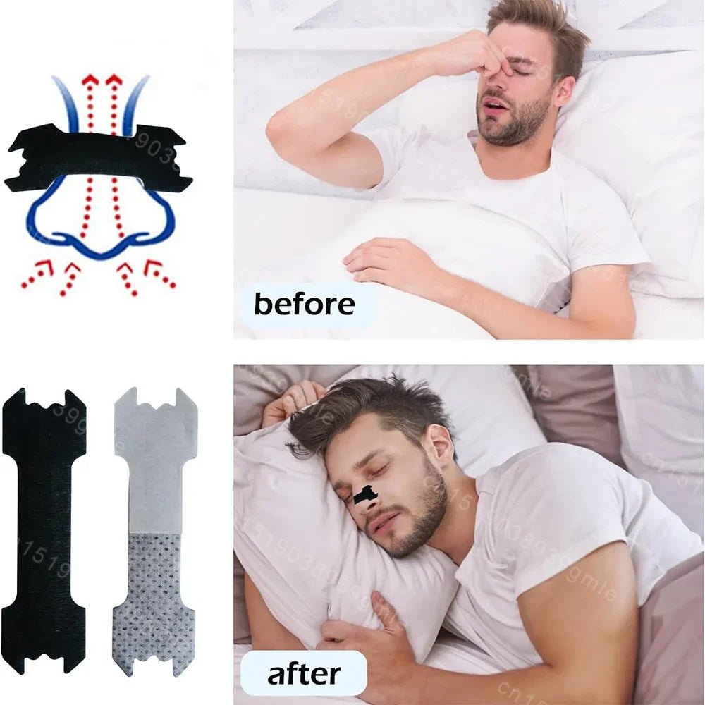 AIRWAYCARE Anti-Snoring Nasal Strips