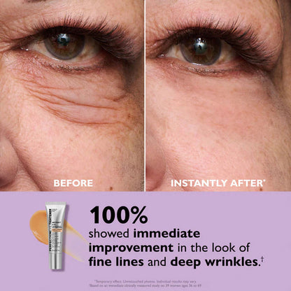 Eye Cream Against Dark Circles & Wrinkles