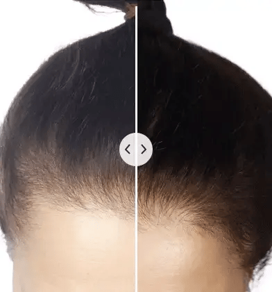 ChicBlend 5-in-1 Hair Comb