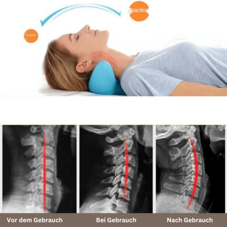 Tranquessence Ergonomic Neck Massage Pillow