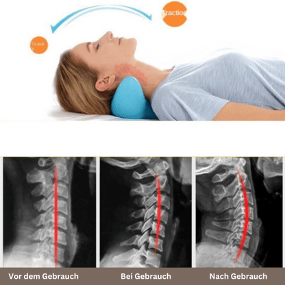 Tranquessence Ergonomic Neck Massage Pillow