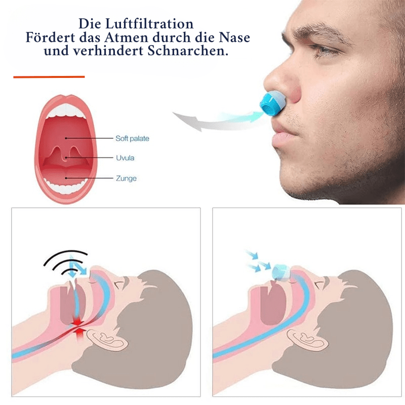 Sleeppure Anti-snoring Air Filter System