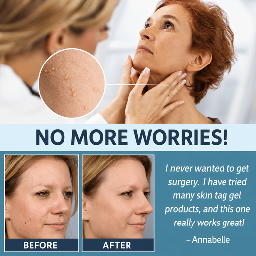 Skin Tag Remover Patches, Painless Non-Invasive Patches for Sensitive & All Skin Types