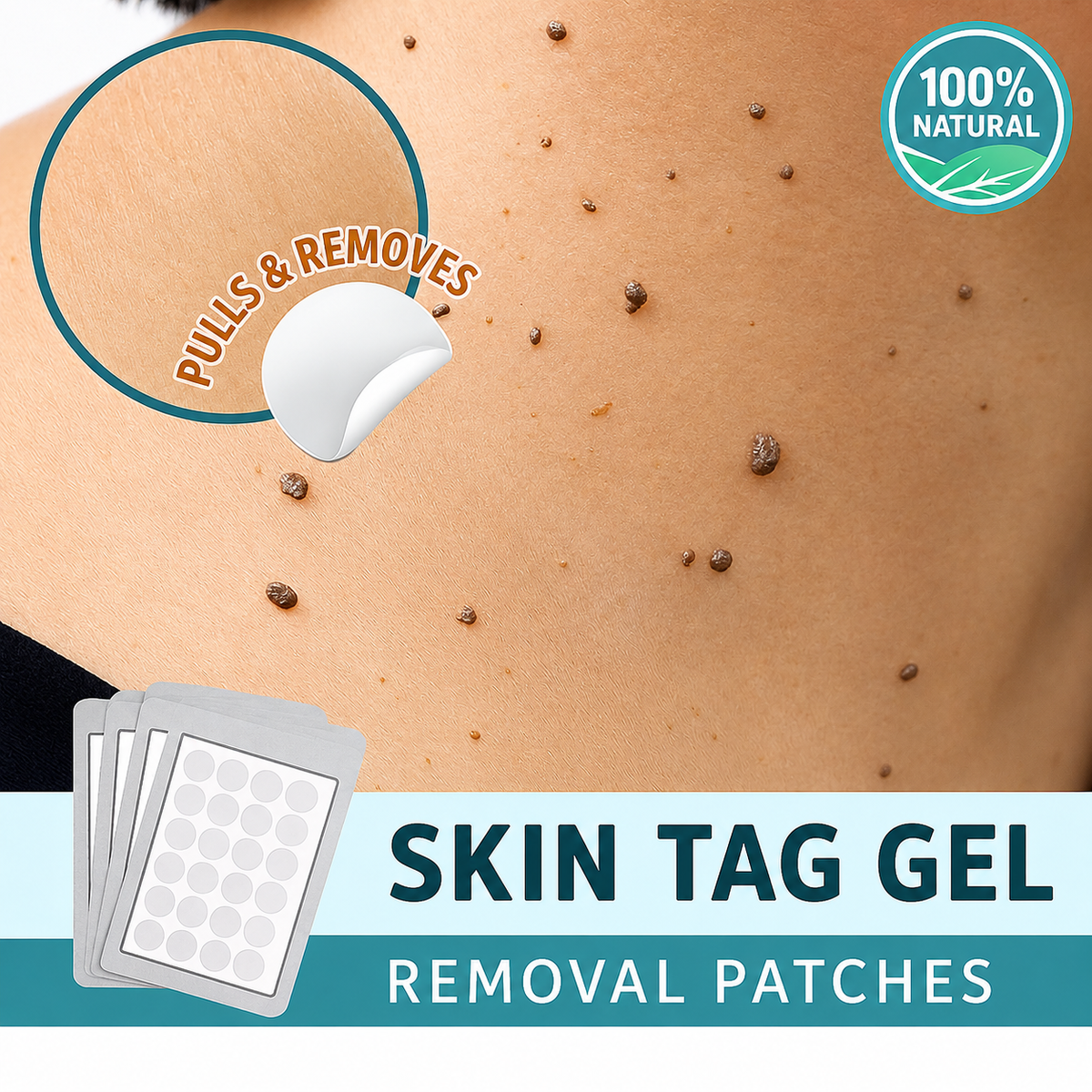 Skin Tag Removal Patches, Painless & Natural