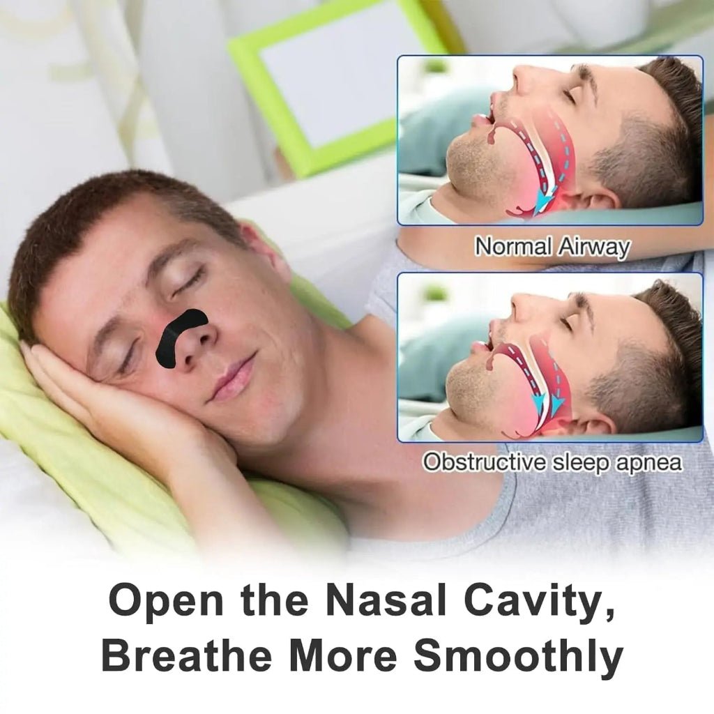 FLOWACTIVE Nasal Breathing Strips