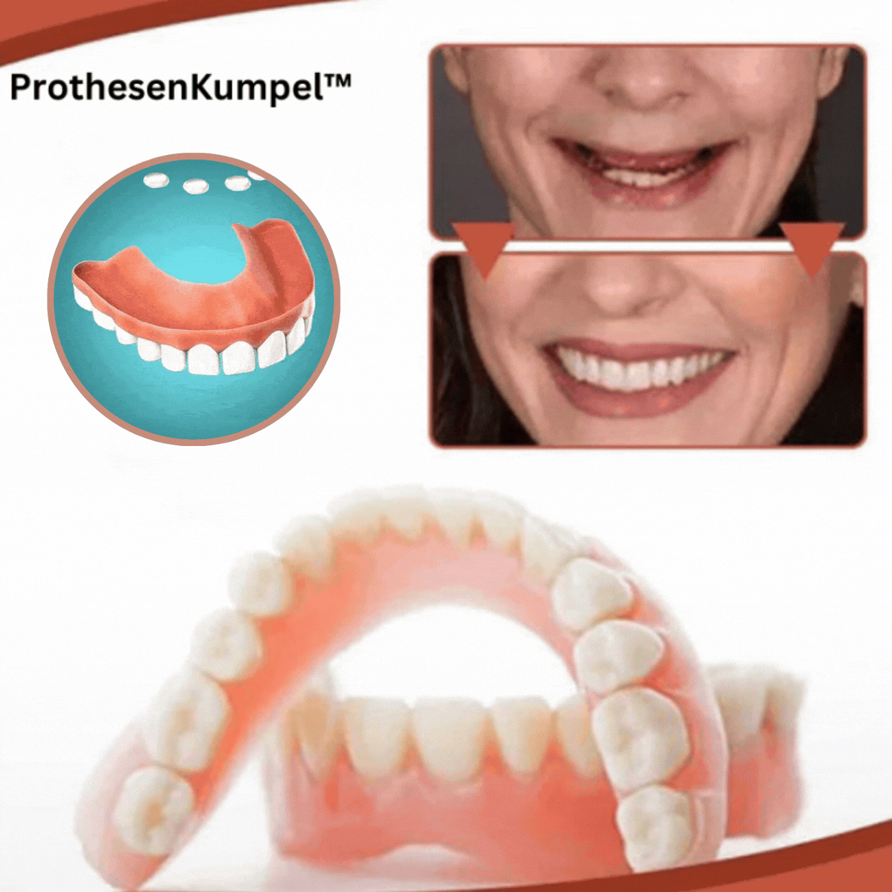 Denture Fitting Kit, Silicone, Comfortable Fit, 5 Sizes