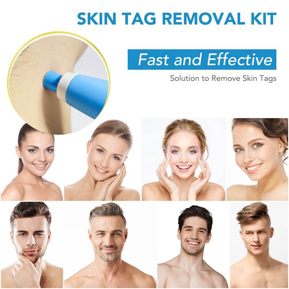 SPOTOFF Skin Spot Remover