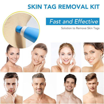 SPOTOFF Skin Spot Remover