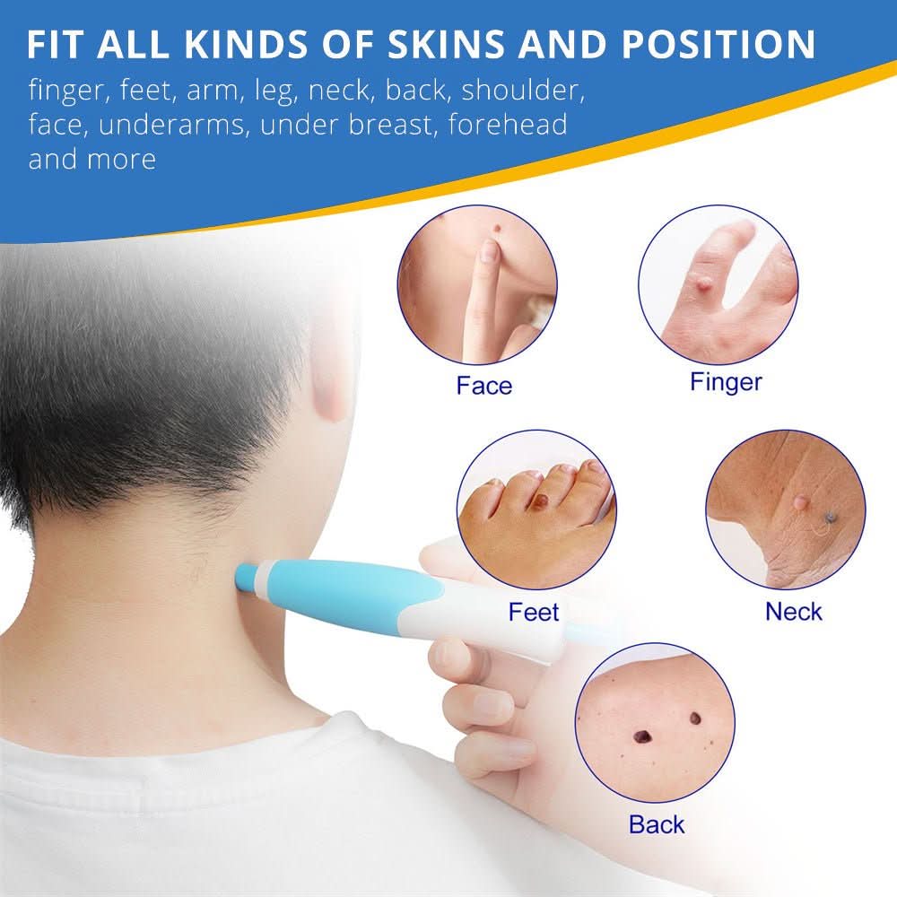 SPOTOFF Skin Spot Remover