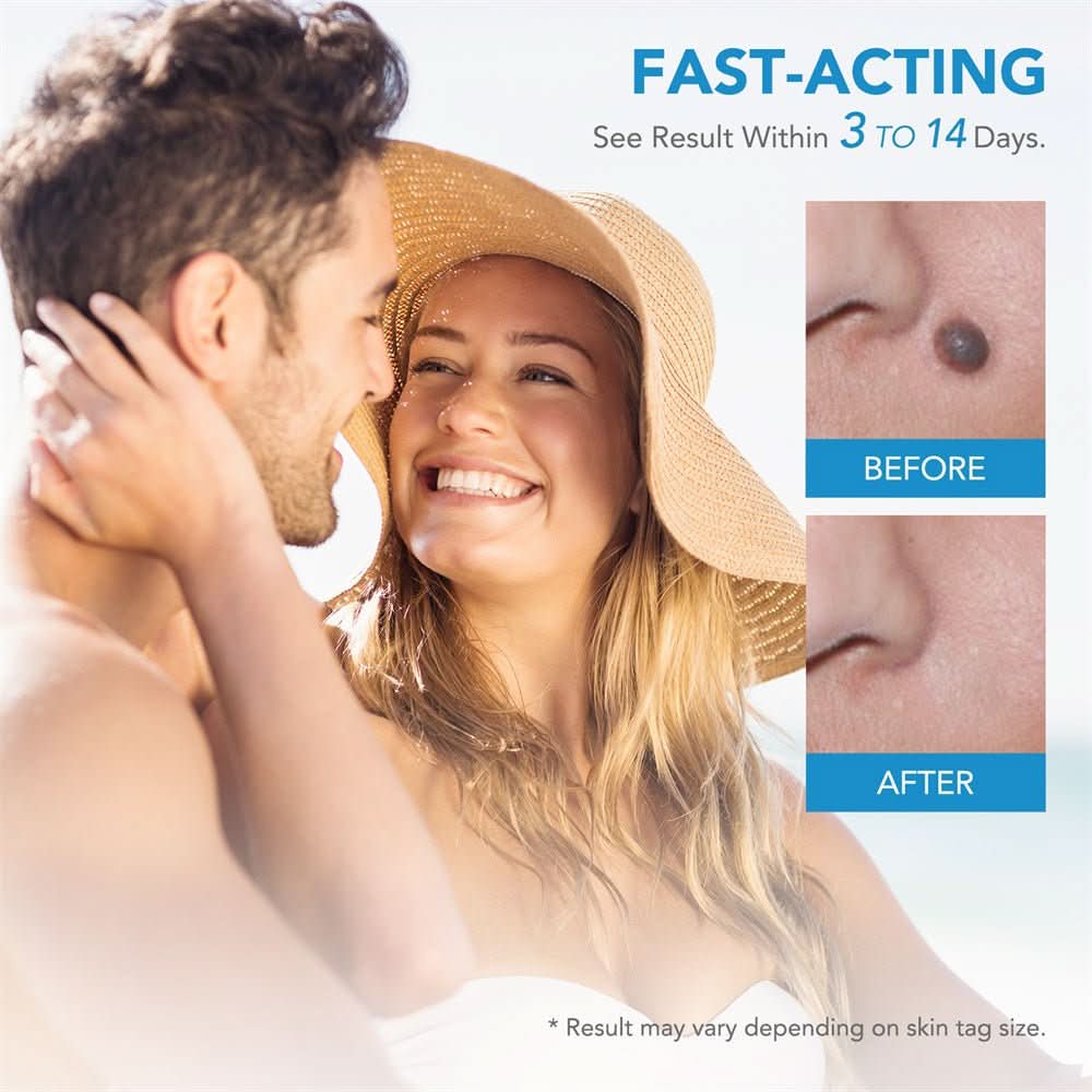 SPOTOFF Skin Spot Remover