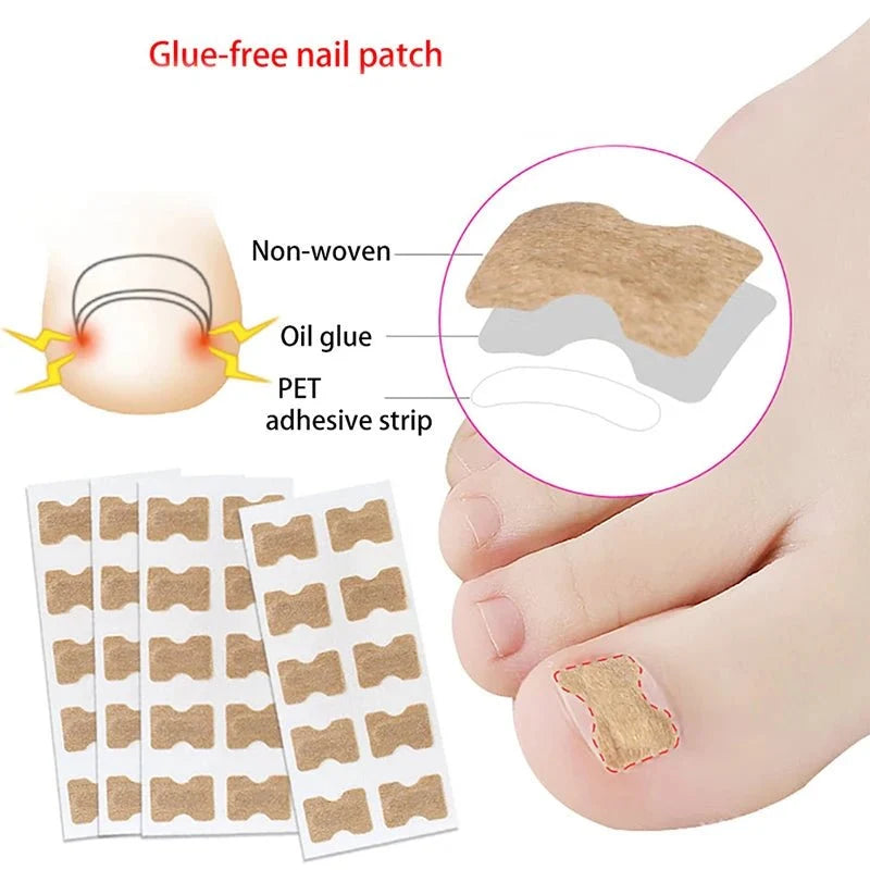 FixaNail Gentle Nail Correction