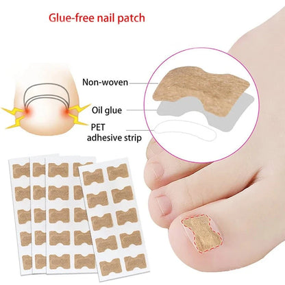 FixaNail Gentle Nail Correction