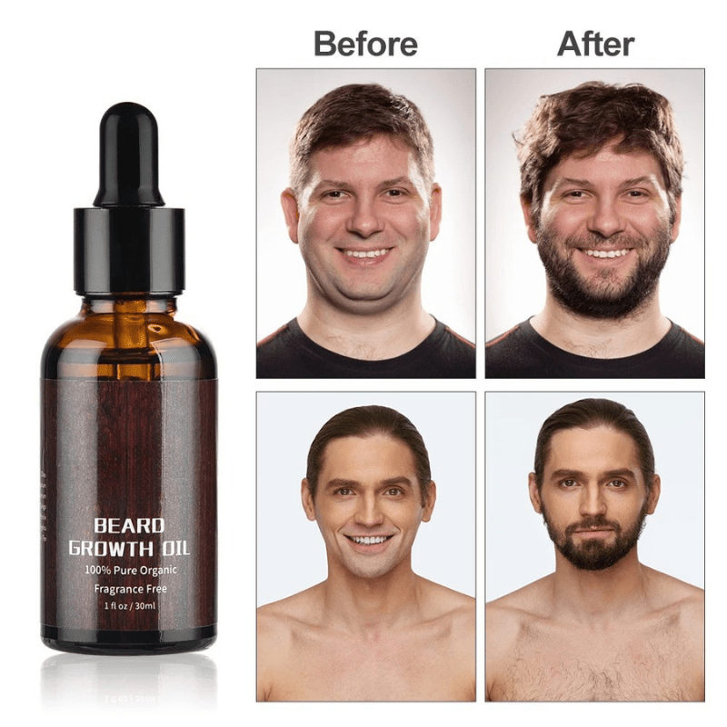 BARTBOOST Beard Growth Kit