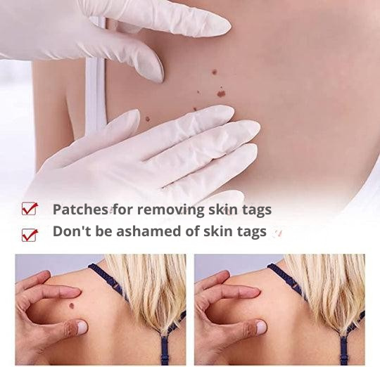 Wart Remover with Precision Applicator, Plant-Based Formula