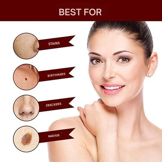 Wart Remover with Precision Applicator, Plant-Based Formula