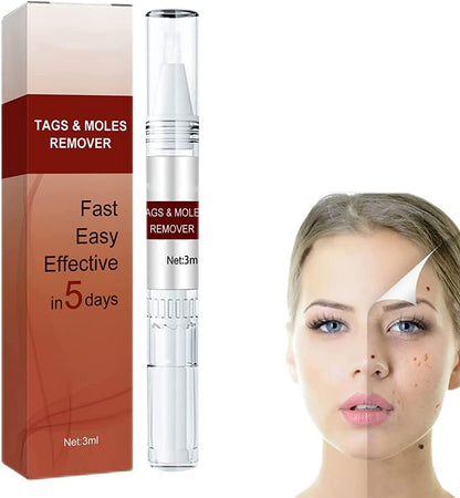 Wart Remover with Precision Applicator, Plant-Based Formula