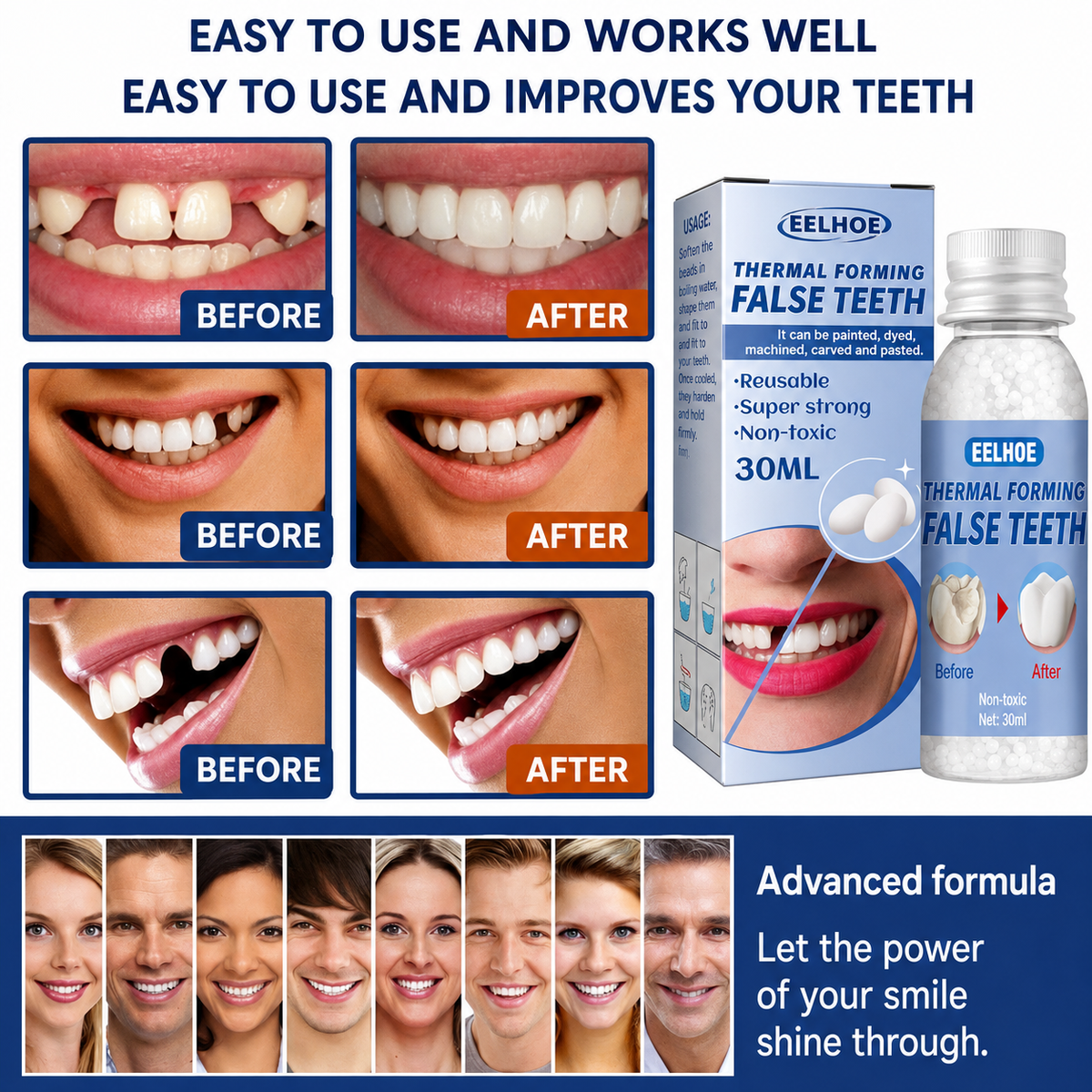 Temporary Tooth Repair Kit for Gaps