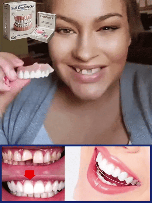 Boil and Bite Denture Kit, At Home Moldable Upper & Lower Cosmetic Dentures