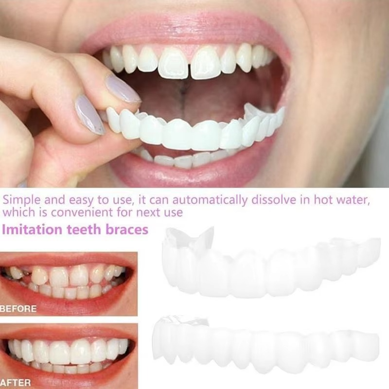 Boil and Bite Dentures for People with Some Teeth – photo 3