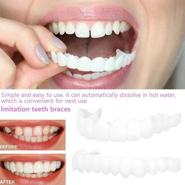 Boil and Bite Dentures for People with Some Teeth, Snap On Upper & Lower Cosmetic Set