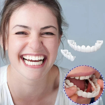 Clip On Veneers with Molding Strip, Upper & Lower Cosmetic Veneer Set for a Natural-Looking Smile – photo 10