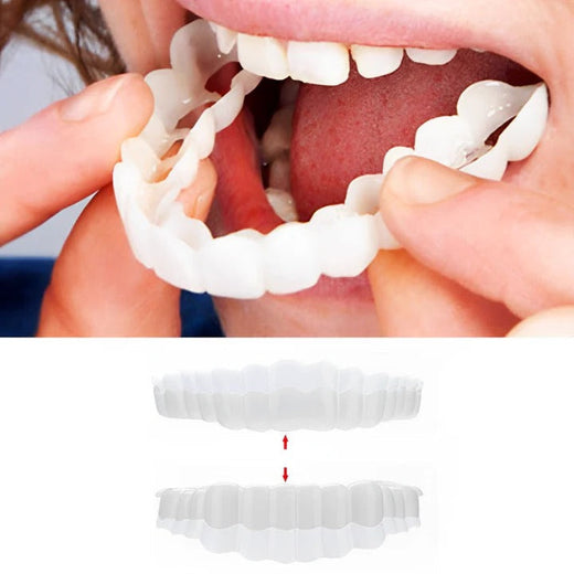 Clip On Veneers with Molding Strip, Upper & Lower Cosmetic Veneer Set for a Natural-Looking Smile