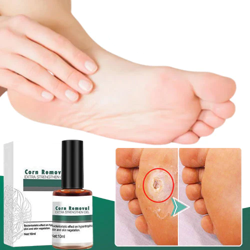 Corn and Callus Remover Gel