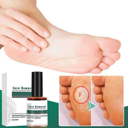 Corn and Callus Remover Gel