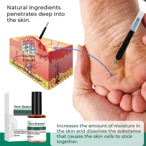 Corn and Callus Remover Gel – photo 2