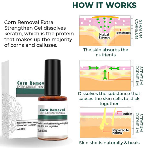 Corn and Callus Remover Gel – photo 4