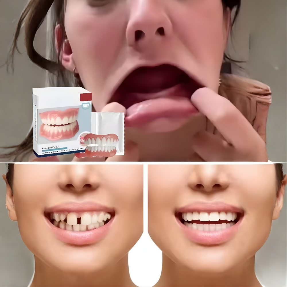 Dentures That Fit Over Existing Teeth – photo 2