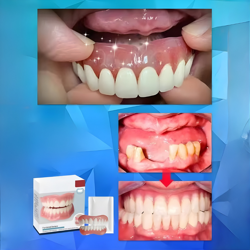 Dentures That Fit Over Existing Teeth – photo 4