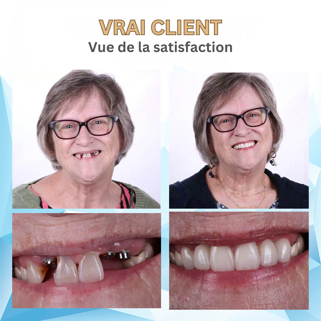 DIY Denture Kit – photo 14