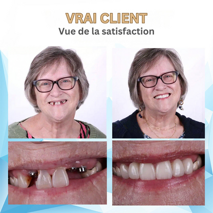 DIY Denture Kit – photo 14
