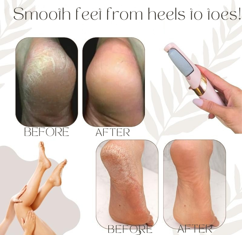 Electric Callus Remover – photo 2