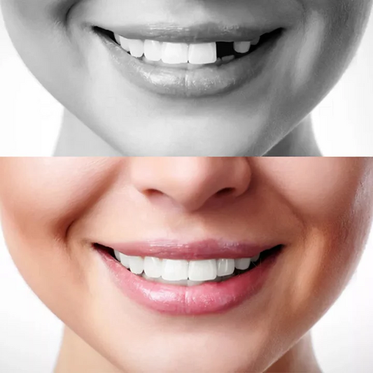 False Teeth Kit